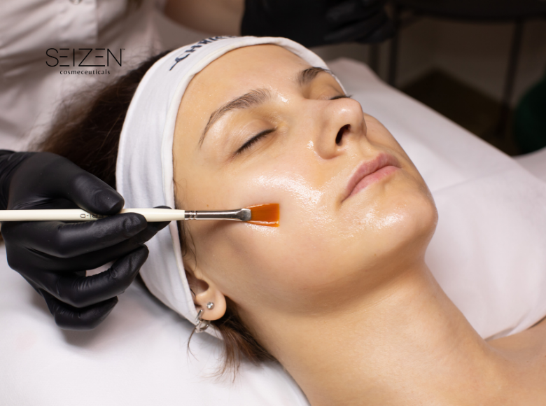 Nên chọn peel bong hay peel không bong?