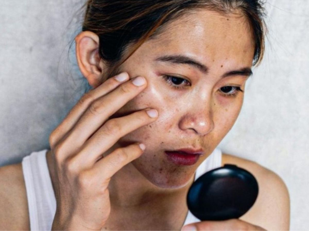 Da xỉn màu, kém sắc 
